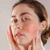 rosacea-harmony-medical-cosmetic-dermatology-medical-aesthetics-67179dccccd68
